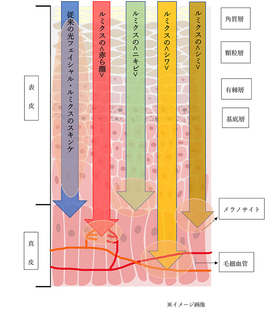 従来のフォトフェイシャルとBBLの違い